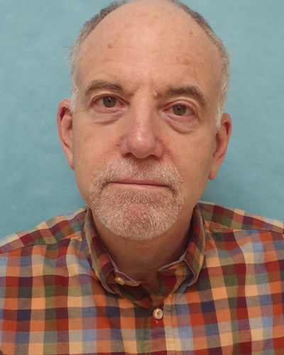 facelift patient